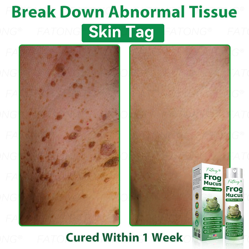 ๐น๐๐ก๐๐๐ยฎ ๐น๐๐๐ ๐๐ข๐๐ข๐  ๐๐๐๐ ๐
๐๐๐๐๐ ๐๐๐๐๐ฆ  โ ๐ ๐๐๐ก๐๐-๐๐๐๐๐ก๐๐ ๐๐๐๐ ๐๐๐ ๐ ๐๐๐๐๐ก ๐๐ข๐ ๐ก๐๐๐๐๐  ๐๐๐๐ฆ ๐ ๐ต๐๐๐ข๐  ๐ก๐๐๐ฃ๐๐-๐ ๐๐ง๐ ๐๐๐๐ก + ๐น๐
๐ธ๐ธ ๐๐ฅ๐๐๐๐ ๐  ๐ โ๐๐๐๐๐๐ โ๏ธ ๐๐๐ฆ ๐๐๐ ๐-๐๐๐๐ ๐ค๐๐กโ 180-๐๐๐ฆ ๐ ๐๐ก๐๐ ๐๐๐๐ก๐๐๐ ๐๐ข๐๐๐๐๐ก๐๐ โฐ ๐ท๐๐โ๐ก ๐ค๐๐๐ก โ ๐กโ๐๐  ๐๐๐๐๐ ๐๐๐ฆ ๐๐๐ฃ๐๐ ๐๐๐๐ ๐๐๐๐!-๐ธ