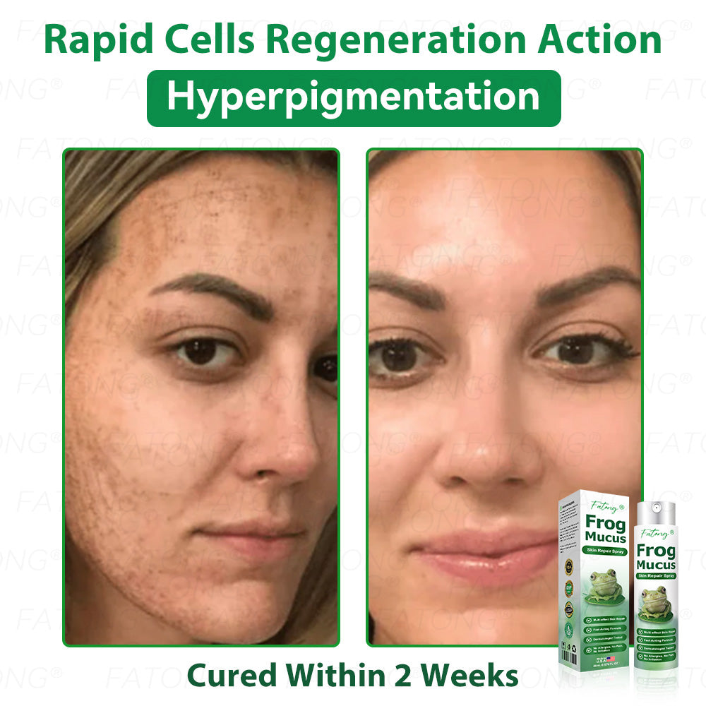 ๐น๐๐ก๐๐๐ยฎ ๐น๐๐๐ ๐๐ข๐๐ข๐  ๐๐๐๐ ๐
๐๐๐๐๐ ๐๐๐๐๐ฆ  โ ๐ ๐๐๐ก๐๐-๐๐๐๐๐ก๐๐ ๐๐๐๐ ๐๐๐ ๐ ๐๐๐๐๐ก ๐๐ข๐ ๐ก๐๐๐๐๐  ๐๐๐๐ฆ ๐ ๐ต๐๐๐ข๐  ๐ก๐๐๐ฃ๐๐-๐ ๐๐ง๐ ๐๐๐๐ก + ๐น๐
๐ธ๐ธ ๐๐ฅ๐๐๐๐ ๐  ๐ โ๐๐๐๐๐๐ โ๏ธ ๐๐๐ฆ ๐๐๐ ๐-๐๐๐๐ ๐ค๐๐กโ 180-๐๐๐ฆ ๐ ๐๐ก๐๐ ๐๐๐๐ก๐๐๐ ๐๐ข๐๐๐๐๐ก๐๐ โฐ ๐ท๐๐โ๐ก ๐ค๐๐๐ก โ ๐กโ๐๐  ๐๐๐๐๐ ๐๐๐ฆ ๐๐๐ฃ๐๐ ๐๐๐๐ ๐๐๐๐!-๐ธ