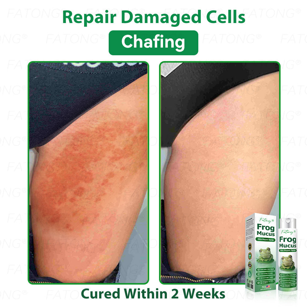 ๐น๐๐ก๐๐๐ยฎ ๐น๐๐๐ ๐๐ข๐๐ข๐  ๐๐๐๐ ๐
๐๐๐๐๐ ๐๐๐๐๐ฆ  โ ๐ ๐๐๐ก๐๐-๐๐๐๐๐ก๐๐ ๐๐๐๐ ๐๐๐ ๐ ๐๐๐๐๐ก ๐๐ข๐ ๐ก๐๐๐๐๐  ๐๐๐๐ฆ ๐ ๐ต๐๐๐ข๐  ๐ก๐๐๐ฃ๐๐-๐ ๐๐ง๐ ๐๐๐๐ก + ๐น๐
๐ธ๐ธ ๐๐ฅ๐๐๐๐ ๐  ๐ โ๐๐๐๐๐๐ โ๏ธ ๐๐๐ฆ ๐๐๐ ๐-๐๐๐๐ ๐ค๐๐กโ 180-๐๐๐ฆ ๐ ๐๐ก๐๐ ๐๐๐๐ก๐๐๐ ๐๐ข๐๐๐๐๐ก๐๐ โฐ ๐ท๐๐โ๐ก ๐ค๐๐๐ก โ ๐กโ๐๐  ๐๐๐๐๐ ๐๐๐ฆ ๐๐๐ฃ๐๐ ๐๐๐๐ ๐๐๐๐!-๐ธ