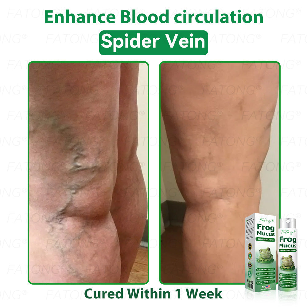 ๐น๐๐ก๐๐๐ยฎ ๐น๐๐๐ ๐๐ข๐๐ข๐  ๐๐๐๐ ๐
๐๐๐๐๐ ๐๐๐๐๐ฆ  โ ๐ ๐๐๐ก๐๐-๐๐๐๐๐ก๐๐ ๐๐๐๐ ๐๐๐ ๐ ๐๐๐๐๐ก ๐๐ข๐ ๐ก๐๐๐๐๐  ๐๐๐๐ฆ ๐ ๐ต๐๐๐ข๐  ๐ก๐๐๐ฃ๐๐-๐ ๐๐ง๐ ๐๐๐๐ก + ๐น๐
๐ธ๐ธ ๐๐ฅ๐๐๐๐ ๐  ๐ โ๐๐๐๐๐๐ โ๏ธ ๐๐๐ฆ ๐๐๐ ๐-๐๐๐๐ ๐ค๐๐กโ 180-๐๐๐ฆ ๐ ๐๐ก๐๐ ๐๐๐๐ก๐๐๐ ๐๐ข๐๐๐๐๐ก๐๐ โฐ ๐ท๐๐โ๐ก ๐ค๐๐๐ก โ ๐กโ๐๐  ๐๐๐๐๐ ๐๐๐ฆ ๐๐๐ฃ๐๐ ๐๐๐๐ ๐๐๐๐!-๐ธ