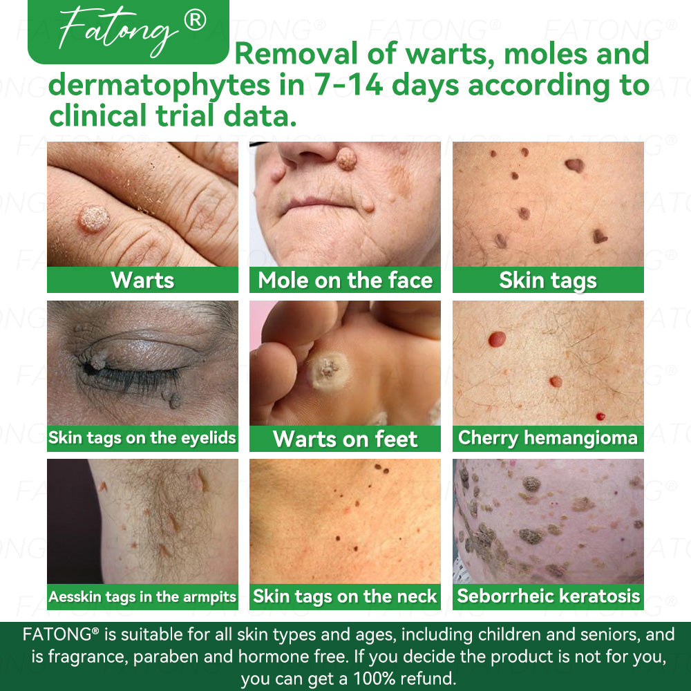 ๐น๐๐ก๐๐๐ยฎ ๐น๐๐๐ ๐๐ข๐๐ข๐  ๐๐๐๐ ๐
๐๐๐๐๐ ๐๐๐๐๐ฆ  โ ๐ ๐๐๐ก๐๐-๐๐๐๐๐ก๐๐ ๐๐๐๐ ๐๐๐ ๐ ๐๐๐๐๐ก ๐๐ข๐ ๐ก๐๐๐๐๐  ๐๐๐๐ฆ ๐ ๐ต๐๐๐ข๐  ๐ก๐๐๐ฃ๐๐-๐ ๐๐ง๐ ๐๐๐๐ก + ๐น๐
๐ธ๐ธ ๐๐ฅ๐๐๐๐ ๐  ๐ โ๐๐๐๐๐๐ โ๏ธ ๐๐๐ฆ ๐๐๐ ๐-๐๐๐๐ ๐ค๐๐กโ 180-๐๐๐ฆ ๐ ๐๐ก๐๐ ๐๐๐๐ก๐๐๐ ๐๐ข๐๐๐๐๐ก๐๐ โฐ ๐ท๐๐โ๐ก ๐ค๐๐๐ก โ ๐กโ๐๐  ๐๐๐๐๐ ๐๐๐ฆ ๐๐๐ฃ๐๐ ๐๐๐๐ ๐๐๐๐!-๐ธ