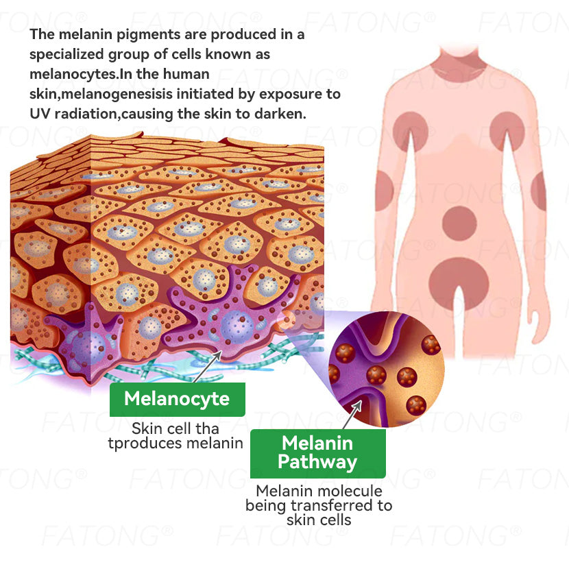 ๐น๐๐ก๐๐๐ยฎ ๐น๐๐๐ ๐๐ข๐๐ข๐  ๐๐๐๐ ๐
๐๐๐๐๐ ๐๐๐๐๐ฆ  โ ๐ ๐๐๐ก๐๐-๐๐๐๐๐ก๐๐ ๐๐๐๐ ๐๐๐ ๐ ๐๐๐๐๐ก ๐๐ข๐ ๐ก๐๐๐๐๐  ๐๐๐๐ฆ ๐ ๐ต๐๐๐ข๐  ๐ก๐๐๐ฃ๐๐-๐ ๐๐ง๐ ๐๐๐๐ก + ๐น๐
๐ธ๐ธ ๐๐ฅ๐๐๐๐ ๐  ๐ โ๐๐๐๐๐๐ โ๏ธ ๐๐๐ฆ ๐๐๐ ๐-๐๐๐๐ ๐ค๐๐กโ 180-๐๐๐ฆ ๐ ๐๐ก๐๐ ๐๐๐๐ก๐๐๐ ๐๐ข๐๐๐๐๐ก๐๐ โฐ ๐ท๐๐โ๐ก ๐ค๐๐๐ก โ ๐กโ๐๐  ๐๐๐๐๐ ๐๐๐ฆ ๐๐๐ฃ๐๐ ๐๐๐๐ ๐๐๐๐!-๐ธ