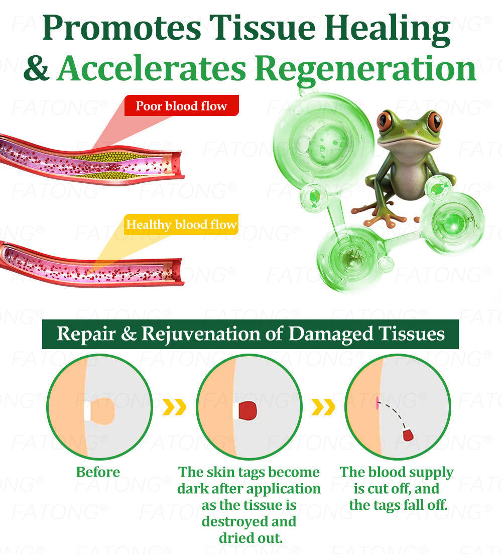 ๐น๐๐ก๐๐๐ยฎ ๐น๐๐๐ ๐๐ข๐๐ข๐  ๐๐๐๐ ๐
๐๐๐๐๐ ๐๐๐๐๐ฆ  โ ๐ ๐๐๐ก๐๐-๐๐๐๐๐ก๐๐ ๐๐๐๐ ๐๐๐ ๐ ๐๐๐๐๐ก ๐๐ข๐ ๐ก๐๐๐๐๐  ๐๐๐๐ฆ ๐ ๐ต๐๐๐ข๐  ๐ก๐๐๐ฃ๐๐-๐ ๐๐ง๐ ๐๐๐๐ก + ๐น๐
๐ธ๐ธ ๐๐ฅ๐๐๐๐ ๐  ๐ โ๐๐๐๐๐๐ โ๏ธ ๐๐๐ฆ ๐๐๐ ๐-๐๐๐๐ ๐ค๐๐กโ 180-๐๐๐ฆ ๐ ๐๐ก๐๐ ๐๐๐๐ก๐๐๐ ๐๐ข๐๐๐๐๐ก๐๐ โฐ ๐ท๐๐โ๐ก ๐ค๐๐๐ก โ ๐กโ๐๐  ๐๐๐๐๐ ๐๐๐ฆ ๐๐๐ฃ๐๐ ๐๐๐๐ ๐๐๐๐!-๐ธ