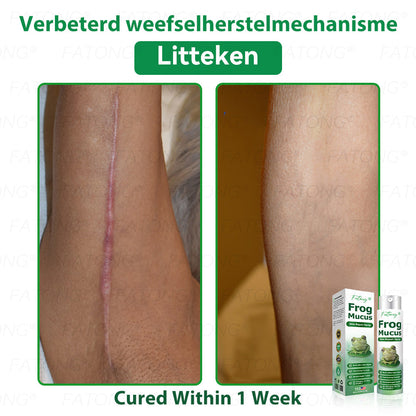 𝐹𝑎𝑡𝑜𝑛𝑔® 𝐹𝑟𝑜𝑔 𝑀𝑢𝑐𝑢𝑠 𝑆𝑘𝑖𝑛 𝑅𝑒𝑝𝑎𝑖𝑟 𝑆𝑝𝑟𝑎𝑦  – 💎 𝑈𝑙𝑡𝑟𝑎-𝑙𝑖𝑚𝑖𝑡𝑒𝑑 𝑑𝑒𝑎𝑙 𝑓𝑜𝑟 𝑠𝑒𝑙𝑒𝑐𝑡 𝑐𝑢𝑠𝑡𝑜𝑚𝑒𝑟𝑠 𝑜𝑛𝑙𝑦 🎁 𝐵𝑜𝑛𝑢𝑠 𝑡𝑟𝑎𝑣𝑒𝑙-𝑠𝑖𝑧𝑒 𝑔𝑖𝑓𝑡 + 𝐹𝑅𝐸𝐸 𝑒𝑥𝑝𝑟𝑒𝑠𝑠 𝑠ℎ𝑖𝑝𝑝𝑖𝑛𝑔 ✔️ 𝑇𝑟𝑦 𝑟𝑖𝑠𝑘-𝑓𝑟𝑒𝑒 𝑤𝑖𝑡ℎ 180-𝑑𝑎𝑦 𝑠𝑎𝑡𝑖𝑠𝑓𝑎𝑐𝑡𝑖𝑜𝑛 𝑔𝑢𝑎𝑟𝑎𝑛𝑡𝑒𝑒 ⏰ 𝐷𝑜𝑛’𝑡 𝑤𝑎𝑖𝑡 — 𝑡ℎ𝑖𝑠 𝑝𝑟𝑖𝑐𝑒 𝑚𝑎𝑦 𝑛𝑒𝑣𝑒𝑟 𝑐𝑜𝑚𝑒 𝑏𝑎𝑐𝑘!-🐸