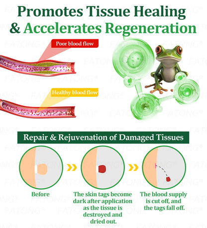 𝐹𝑎𝑡𝑜𝑛𝑔® 𝐹𝑟𝑜𝑔 𝑀𝑢𝑐𝑢𝑠 𝑆𝑘𝑖𝑛 𝑅𝑒𝑝𝑎𝑖𝑟 𝑆𝑝𝑟𝑎𝑦  – 💎 𝑈𝑙𝑡𝑟𝑎-𝑙𝑖𝑚𝑖𝑡𝑒𝑑 𝑑𝑒𝑎𝑙 𝑓𝑜𝑟 𝑠𝑒𝑙𝑒𝑐𝑡 𝑐𝑢𝑠𝑡𝑜𝑚𝑒𝑟𝑠 𝑜𝑛𝑙𝑦 🎁 𝐵𝑜𝑛𝑢𝑠 𝑡𝑟𝑎𝑣𝑒𝑙-𝑠𝑖𝑧𝑒 𝑔𝑖𝑓𝑡 + 𝐹𝑅𝐸𝐸 𝑒𝑥𝑝𝑟𝑒𝑠𝑠 𝑠ℎ𝑖𝑝𝑝𝑖𝑛𝑔 ✔️ 𝑇𝑟𝑦 𝑟𝑖𝑠𝑘-𝑓𝑟𝑒𝑒 𝑤𝑖𝑡ℎ 180-𝑑𝑎𝑦 𝑠𝑎𝑡𝑖𝑠𝑓𝑎𝑐𝑡𝑖𝑜𝑛 𝑔𝑢𝑎𝑟𝑎𝑛𝑡𝑒𝑒 ⏰ 𝐷𝑜𝑛’𝑡 𝑤𝑎𝑖𝑡 — 𝑡ℎ𝑖𝑠 𝑝𝑟𝑖𝑐𝑒 𝑚𝑎𝑦 𝑛𝑒𝑣𝑒𝑟 𝑐𝑜𝑚𝑒 𝑏𝑎𝑐𝑘!-🐸