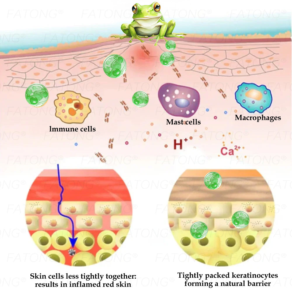 𝐹𝑎𝑡𝑜𝑛𝑔® 𝐹𝑟𝑜𝑔 𝑀𝑢𝑐𝑢𝑠 𝑆𝑘𝑖𝑛 𝑅𝑒𝑝𝑎𝑖𝑟 𝑆𝑝𝑟𝑎𝑦  – 💎 𝑈𝑙𝑡𝑟𝑎-𝑙𝑖𝑚𝑖𝑡𝑒𝑑 𝑑𝑒𝑎𝑙 𝑓𝑜𝑟 𝑠𝑒𝑙𝑒𝑐𝑡 𝑐𝑢𝑠𝑡𝑜𝑚𝑒𝑟𝑠 𝑜𝑛𝑙𝑦 🎁 𝐵𝑜𝑛𝑢𝑠 𝑡𝑟𝑎𝑣𝑒𝑙-𝑠𝑖𝑧𝑒 𝑔𝑖𝑓𝑡 + 𝐹𝑅𝐸𝐸 𝑒𝑥𝑝𝑟𝑒𝑠𝑠 𝑠ℎ𝑖𝑝𝑝𝑖𝑛𝑔 ✔️ 𝑇𝑟𝑦 𝑟𝑖𝑠𝑘-𝑓𝑟𝑒𝑒 𝑤𝑖𝑡ℎ 180-𝑑𝑎𝑦 𝑠𝑎𝑡𝑖𝑠𝑓𝑎𝑐𝑡𝑖𝑜𝑛 𝑔𝑢𝑎𝑟𝑎𝑛𝑡𝑒𝑒 ⏰ 𝐷𝑜𝑛’𝑡 𝑤𝑎𝑖𝑡 — 𝑡ℎ𝑖𝑠 𝑝𝑟𝑖𝑐𝑒 𝑚𝑎𝑦 𝑛𝑒𝑣𝑒𝑟 𝑐𝑜𝑚𝑒 𝑏𝑎𝑐𝑘!-🐸