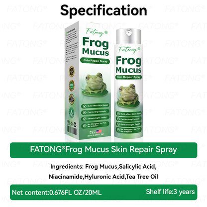 𝐹𝑎𝑡𝑜𝑛𝑔® 𝐹𝑟𝑜𝑔 𝑀𝑢𝑐𝑢𝑠 𝑆𝑘𝑖𝑛 𝑅𝑒𝑝𝑎𝑖𝑟 𝑆𝑝𝑟𝑎𝑦  – 💎 𝑈𝑙𝑡𝑟𝑎-𝑙𝑖𝑚𝑖𝑡𝑒𝑑 𝑑𝑒𝑎𝑙 𝑓𝑜𝑟 𝑠𝑒𝑙𝑒𝑐𝑡 𝑐𝑢𝑠𝑡𝑜𝑚𝑒𝑟𝑠 𝑜𝑛𝑙𝑦 🎁 𝐵𝑜𝑛𝑢𝑠 𝑡𝑟𝑎𝑣𝑒𝑙-𝑠𝑖𝑧𝑒 𝑔𝑖𝑓𝑡 + 𝐹𝑅𝐸𝐸 𝑒𝑥𝑝𝑟𝑒𝑠𝑠 𝑠ℎ𝑖𝑝𝑝𝑖𝑛𝑔 ✔️ 𝑇𝑟𝑦 𝑟𝑖𝑠𝑘-𝑓𝑟𝑒𝑒 𝑤𝑖𝑡ℎ 180-𝑑𝑎𝑦 𝑠𝑎𝑡𝑖𝑠𝑓𝑎𝑐𝑡𝑖𝑜𝑛 𝑔𝑢𝑎𝑟𝑎𝑛𝑡𝑒𝑒 ⏰ 𝐷𝑜𝑛’𝑡 𝑤𝑎𝑖𝑡 — 𝑡ℎ𝑖𝑠 𝑝𝑟𝑖𝑐𝑒 𝑚𝑎𝑦 𝑛𝑒𝑣𝑒𝑟 𝑐𝑜𝑚𝑒 𝑏𝑎𝑐𝑘!-🐸